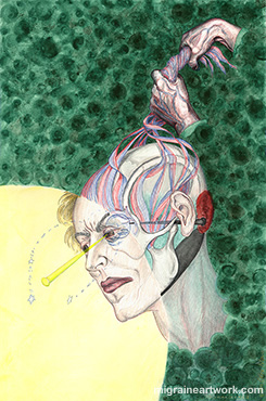 Migraine in a Split